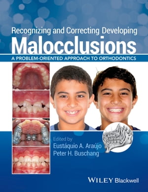 Recognizing and Correcting Developing Malocclusions A Problem-Oriented Approach to Orthodontics