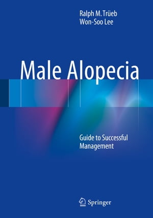 Male Alopecia