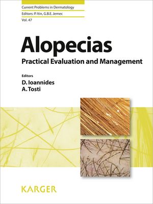 Alopecias - Practical Evaluation and Management【電子書籍】[ P. Itin ]