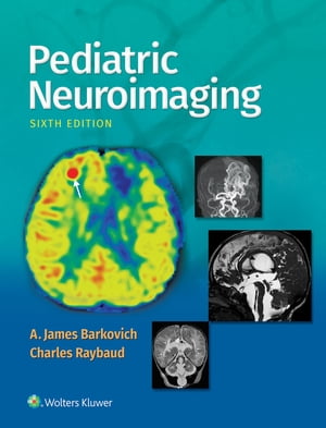 Pediatric Neuroimaging【電子書籍】 A. James Barkovich