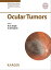 Ocular Tumors