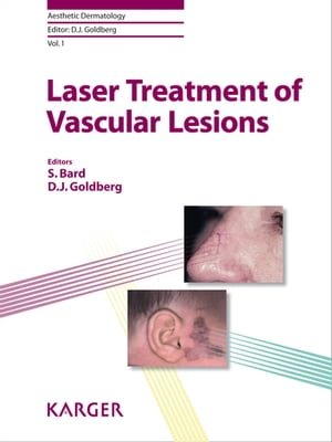 楽天楽天Kobo電子書籍ストアLaser Treatment of Vascular Lesions【電子書籍】