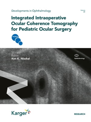 Integrated Intraoperative Ocular Coherence Tomography for Pediatric Ocular Surgery