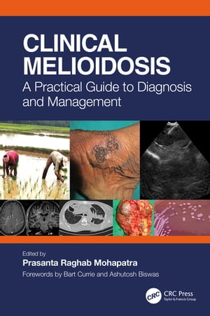 Clinical Melioidosis