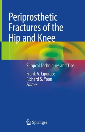 Periprosthetic Fractures of the Hip and Knee Surgical Techniques and TipsŻҽҡ