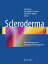 Scleroderma