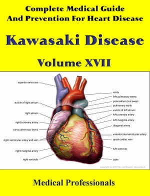 A Complete Medical Guide and Prevention For Heart Diseases Volume XVII; Kawasaki Disease