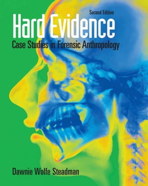 楽天楽天Kobo電子書籍ストアHard Evidence Case Studies in Forensic Anthropology【電子書籍】