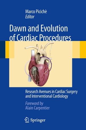 Dawn and Evolution of Cardiac Procedures Research Avenues in Cardiac Surgery and Interventional Cardiology【電子書籍】