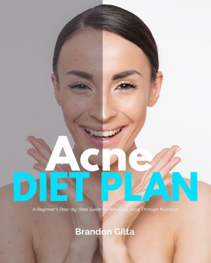 Acne Diet Plan