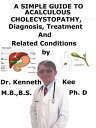 A Simple Guide to Acalculous Cholecystopathy, Di