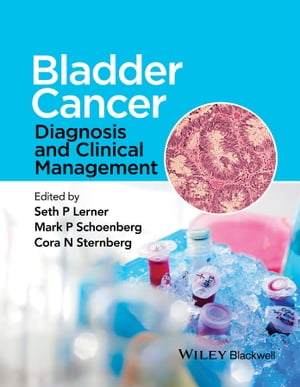 Bladder Cancer Diagnosis and Clinical Management【電子書籍】