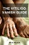 THE VITILIGO VANISH GUIDE