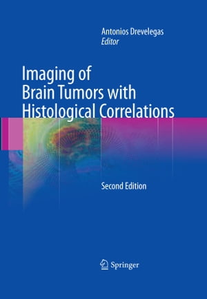 Imaging of Brain Tumors with Histological Correlations