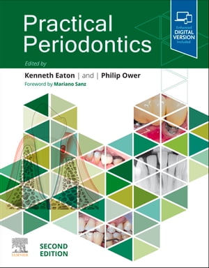 Practical Periodontics - E-Book