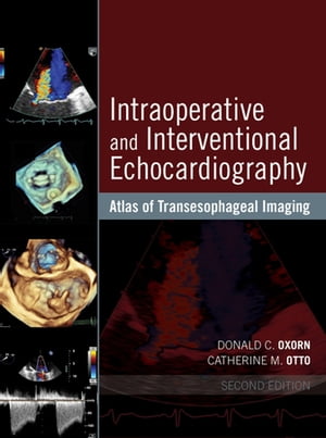 Intraoperative and Interventional Echocardiography