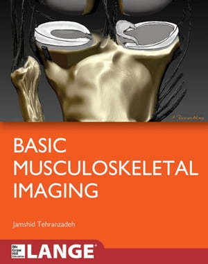 Basic Musculoskeletal Imaging