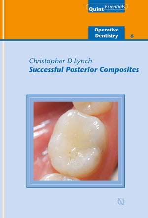 Successful Posterior Composites【電子書籍】[ Christopher D. Lynch ]