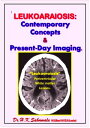 LEUKOARAIOSIS: Contemporary Concepts and Present-Day Imaging.【電子書籍】[ Dr. Hakim. ...