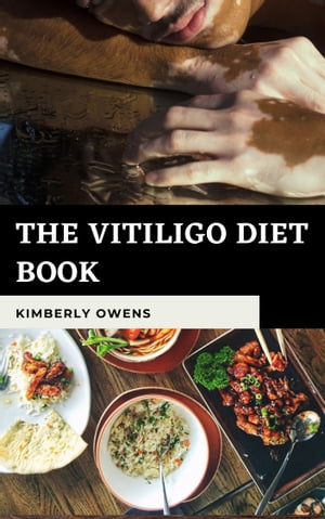 The Vitiligo Diet Book Complete Ultimate Recipe to Treat Vitiligo With Diet Without Using Pharmaceutical Drugs