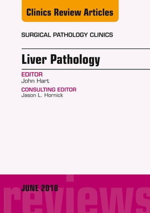 Liver Pathology, An Issue of Surgical Pathology Clinics【電子書籍】 John Hart, MD