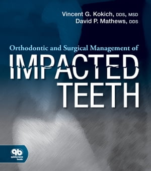 Orthodontic and Surgical Management of Impacted Teeth