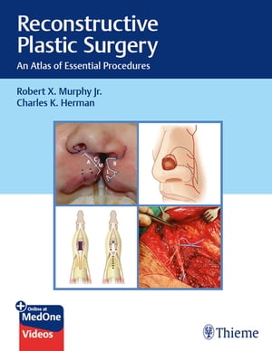 Reconstructive Plastic Surgery An Atlas of Essential Procedures