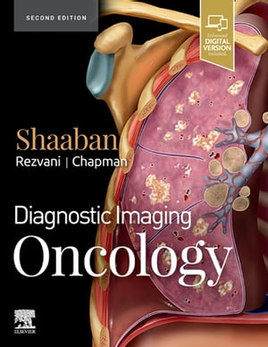 Diagnostic Imaging: Oncology E-Book