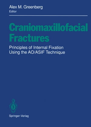 楽天楽天Kobo電子書籍ストアCraniomaxillofacial Fractures Principles of Internal Fixation Using the AO/ASIF Technique【電子書籍】