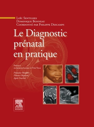 Le Diagnostic prénatal en pratique