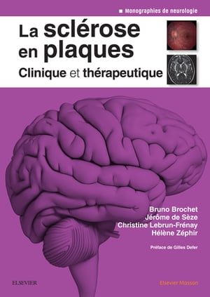 La scl?rose en plaques - Clinique et th?rapeutiq