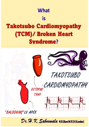 What is Takotsubo(stress) Cardiomyopathy (TCM)/ Broken Heart Syndrome?