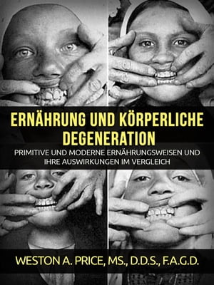 Ern?hrung und k?rperliche Degeneration (?bersetzt)