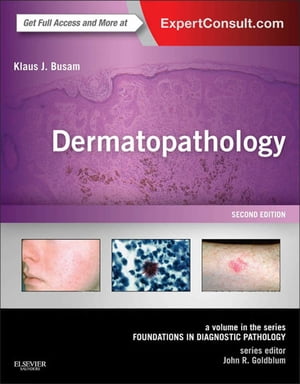 Dermatopathology A Volume in the Series: Foundations in Diagnostic Pathology (Expert Consult - Online)【電子書籍】 Klaus J. Busam, MD