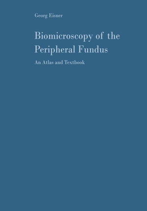 Biomicroscopy of the Peripheral Fundus An Atlas and TextbookŻҽҡ[ H. Goldmann ]