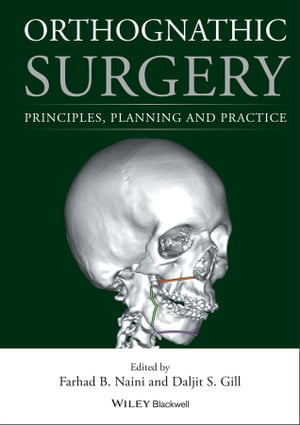 Orthognathic Surgery