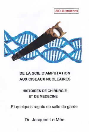 De la scie d’amputation aux ciseaux nucléaires