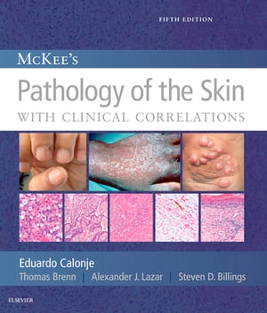 McKee 039 s Pathology of the Skin, 2 Volume Set E-Book【電子書籍】 J. Eduardo Calonje, MD, DipRCPath