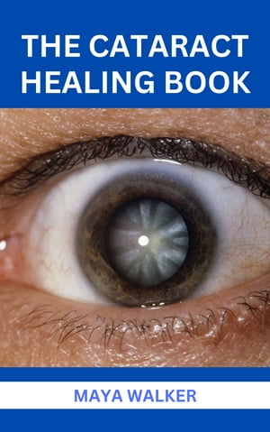 THE CATARACT HEALING BOOK