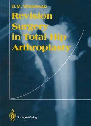 Revision Surgery in Total Hip Arthroplasty