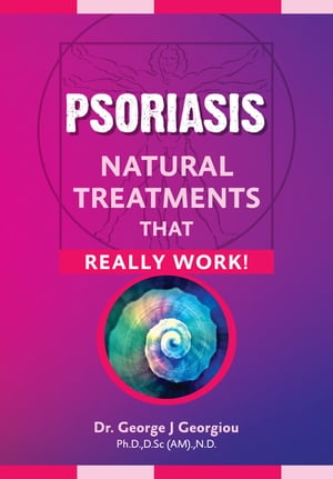 Psoriasis