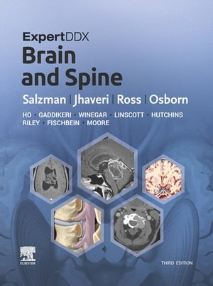 ExpertDDx: Brain and Spine E-Book