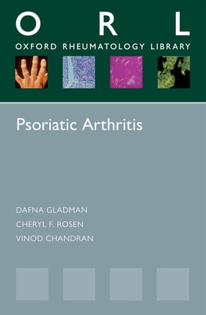 Psoriatic Arthritis【電子書籍】[ Dafna Gladman ]