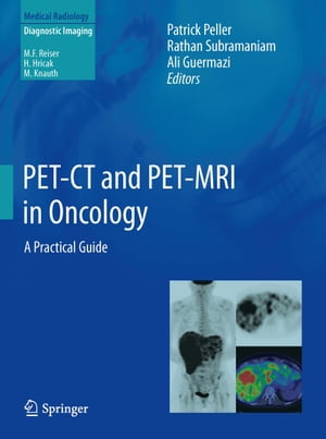 PET-CT and PET-MRI in Oncology