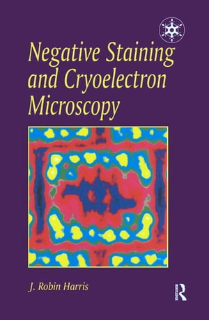 Negative Staining and Cryoelectron Microscopy