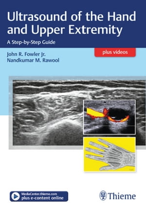 Ultrasound of the Hand and Upper Extremity