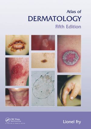 Atlas of Dermatology, Fifth EditionŻҽҡ[ Lionel Fry ]