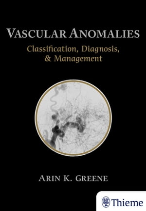 Vascular Anomalies