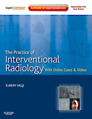 The Practice of Interventional Radiology