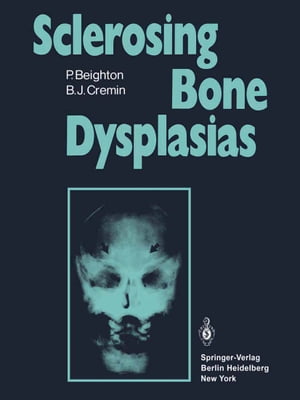 Sclerosing Bone Dysplasias